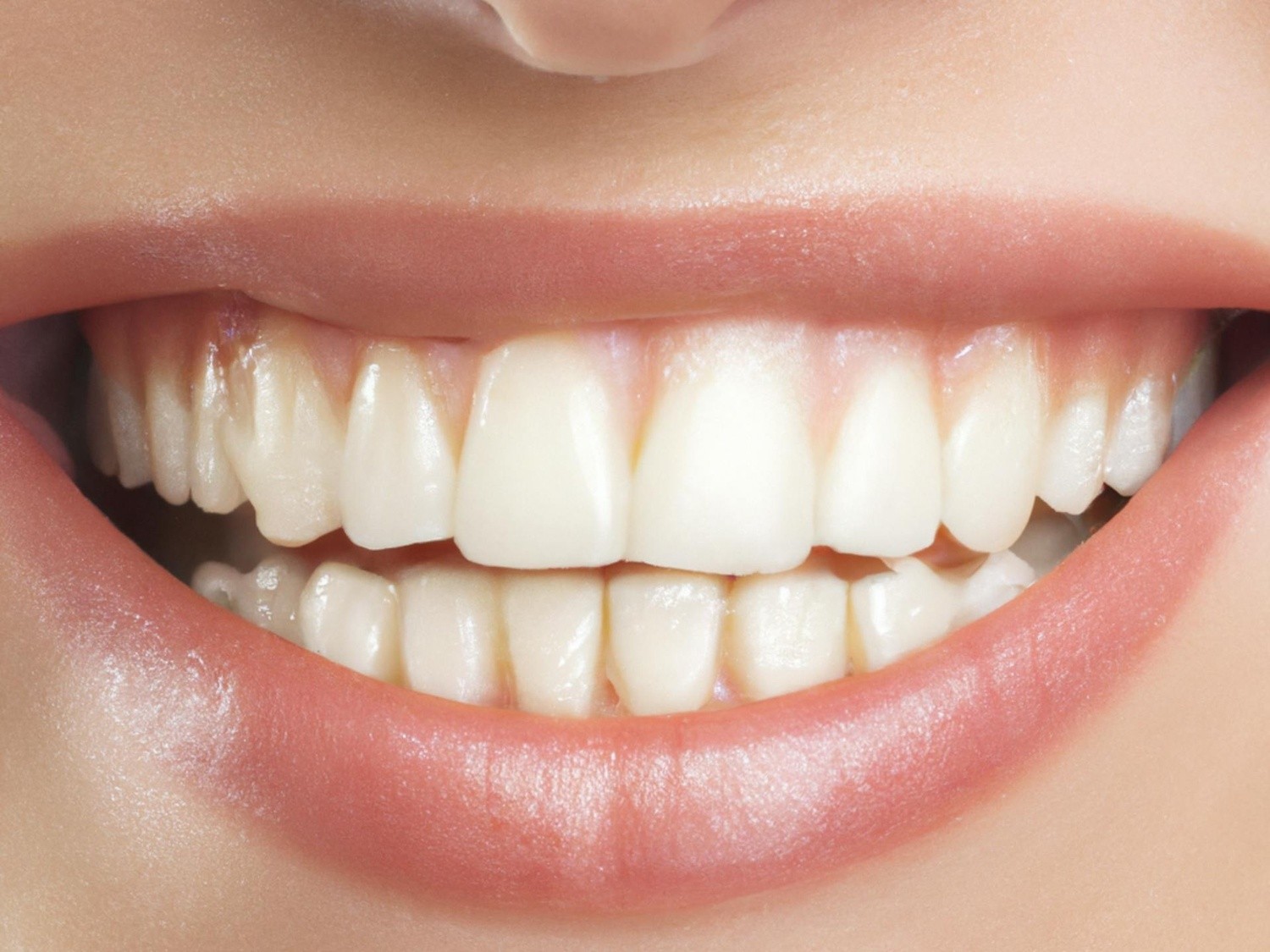 Denture Adhesives