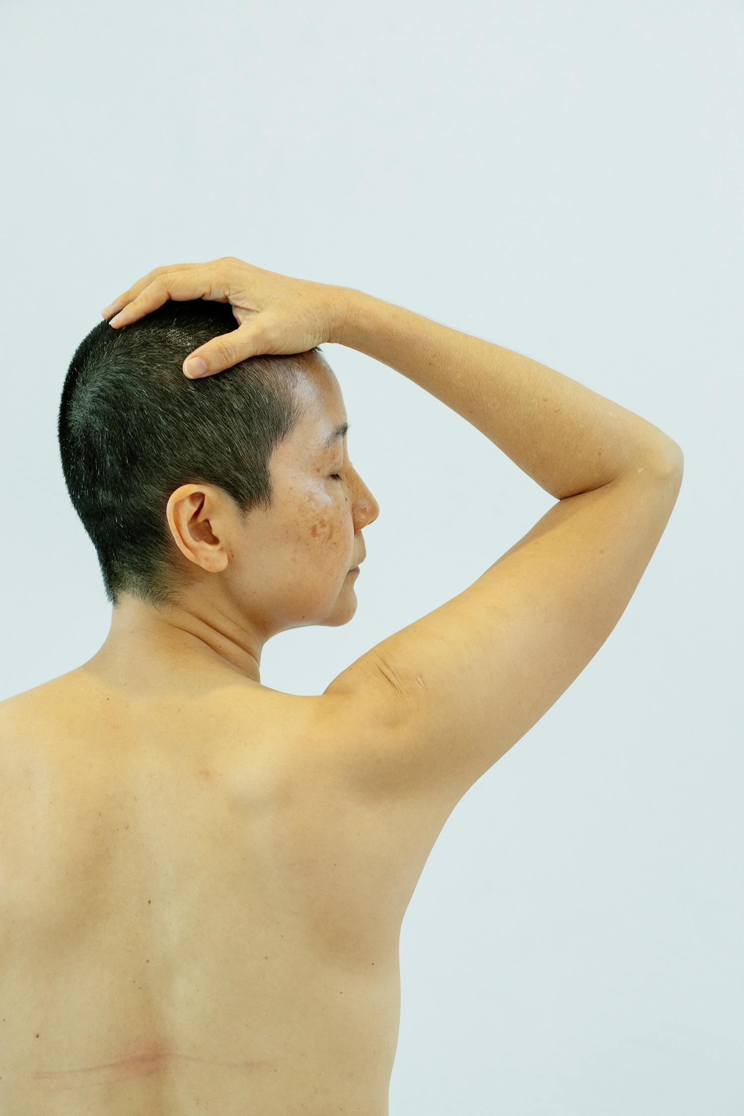 Hair Loss
