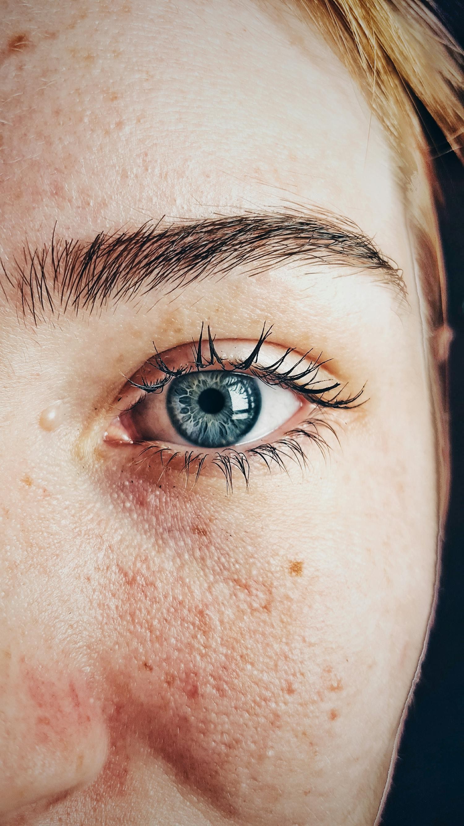 Eyes